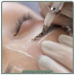 دلایل برتری فیبروز چیست؟