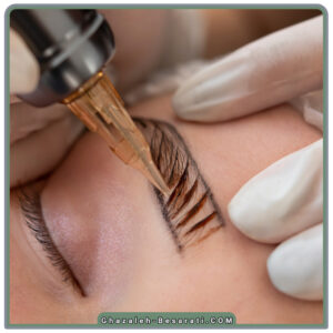 بهترین مرکز میکروبلیدینگ در رشت